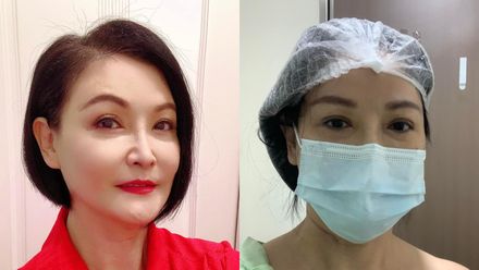 才罹乳癌→切除7公分腫瘤！資深女星自爆曾染子宮頸癌「2顆卵巢也沒了」近況曝